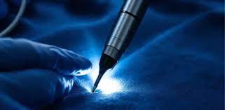 أفضل طبيب لعلاج البواسير بالليزر في الأردن