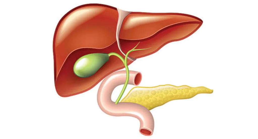 متى يجب إجراء عملية المرارة